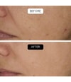 Produktbild 5 von 6, COCUNAT Clinical Gesichtsserum