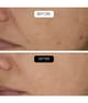 Produktbild 5 von 6, COCUNAT Clinical Gesichtsserum
