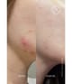 Acnemy Postzit Pickeltupfer 30 ml 8436585432011 visual-shot_de