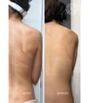 Produktbild 4 von 6, Acnemy Zitback Körperspray