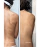 Produktbild 4 von 6, Acnemy Zitback Körperspray