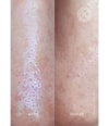 Produktbild 4 von 6, Acnemy Zitproof Pimple Patches