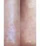 Productafbeelding 4 van 6, Acnemy Zitproof Pimple Patches
