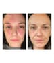 Produktbild 3 von 4, Pestle & Mortar DERMA SKINCARE Gesichtscreme