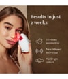 Produktbild 6 von 6, Silk'n Bright Lux Gesichtsbürste