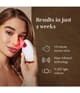 Produktbild 6 von 6, Silk'n Bright Lux Gesichtsbürste