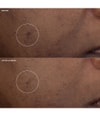 Produktbild 5 von 5, CLINIQUE Even Better Gesichtscreme