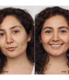 Produktbild 2 von 3, CLINIQUE Even Better Flüssige Foundation