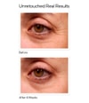 Produktbild 2 von 4, Murad Resurgence Augenserum