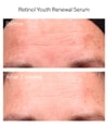 Produktbild 2 von 4, Murad Resurgence Gesichtsserum