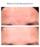 Produktbild 2 von 4, Murad Resurgence Gesichtsserum