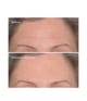 Produktbild 2 von 5, Murad Resurgence Faltenfüller