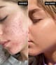 Produktbillede 4 af 5, The INKEY List Niacinamide Serum Serum