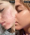 Produktbild 4 von 5, The INKEY List Niacinamide Serum Gesichtsserum