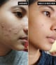 Produktbillede 4 af 5, The INKEY List Salicylic Acid Cleanser Cleansing gel