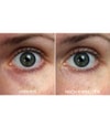 Produktbild 3 von 4, VITAYES Perfector Augenserum