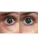 Produktbillede 3 af 4, VITAYES Perfector Øjenserum