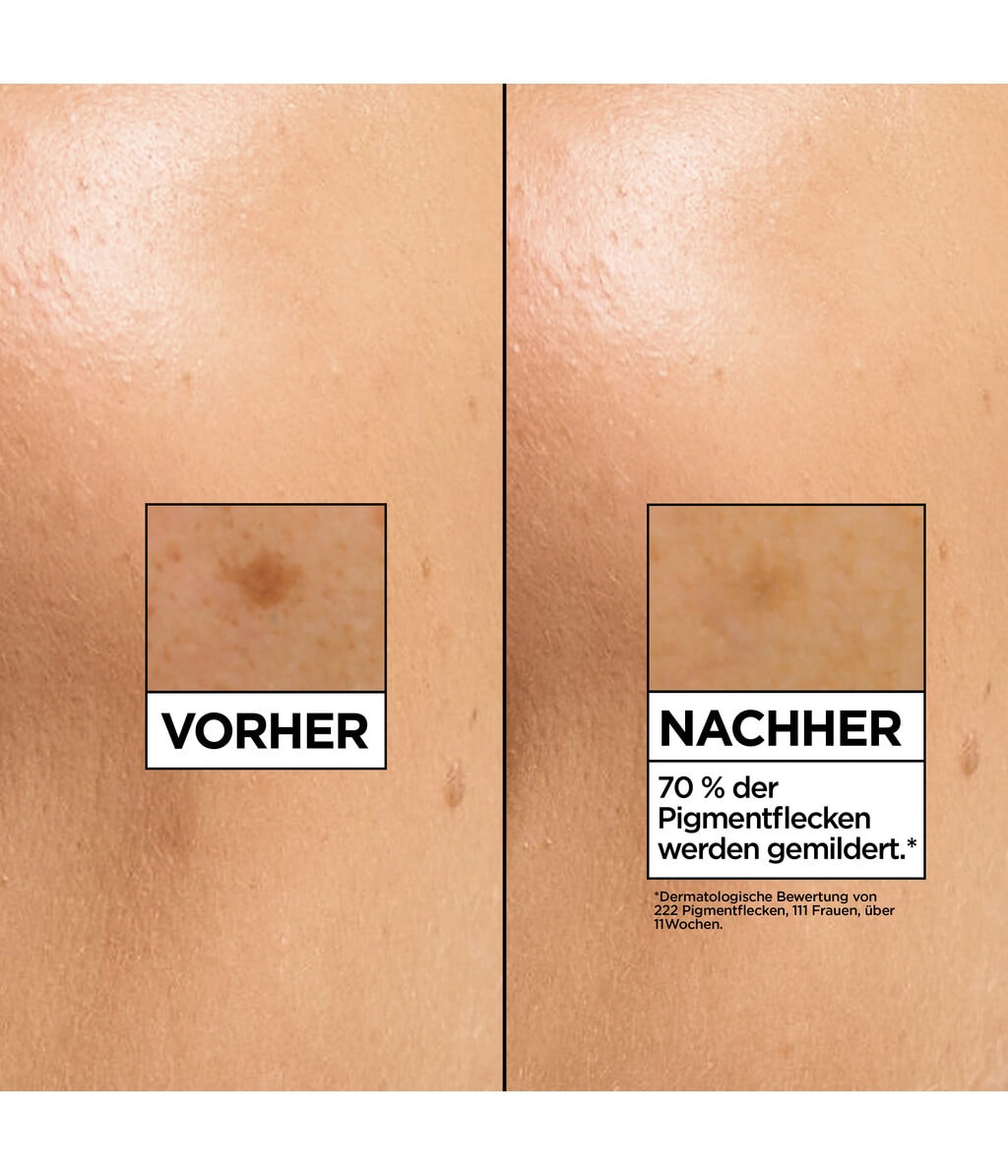 Сыворотка для лица Garnier SkinActive Vitamin C Brightening Serum, осветляющая, с ниацинамидом, 30 мл — фото 4