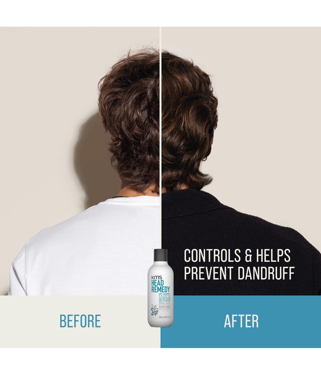 Шампунь против перхоти KMS Headremedy Anti-Dandruff успокаивает зуд, 300 мл — фото 3