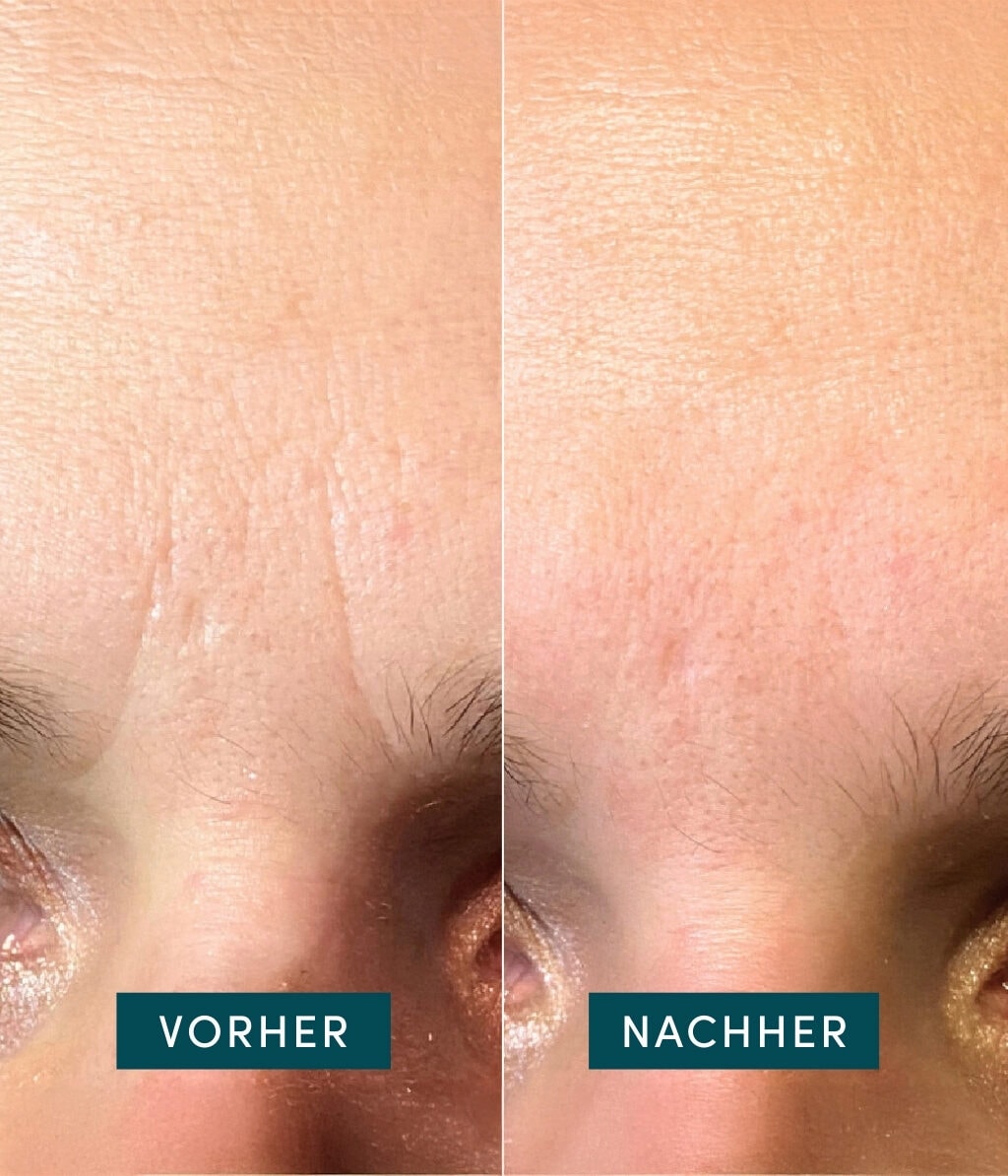 Produktbild 3 von 6, APRICOT Gesicht Patches Gesichtsmaske