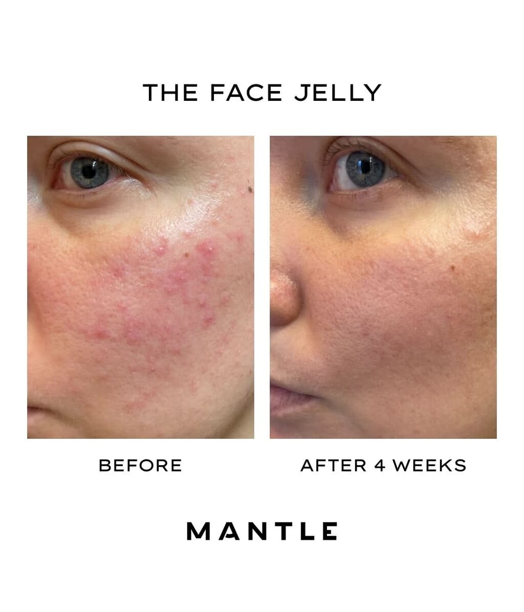 Гель-крем для лица Mantle The Face Jelly увлажняющий, 50 мл — фото 4