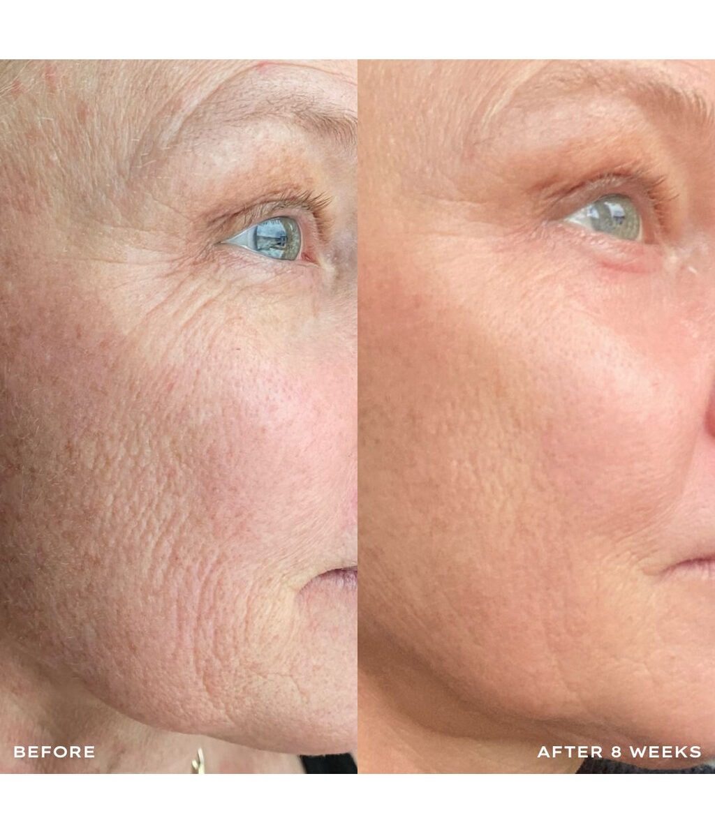 Сыворотка для лица Mantle The Retinol Serum Transformative Vitamin A Complex Serum с ретинолом 0,3%, обновляющая, 30 мл — фото 4
