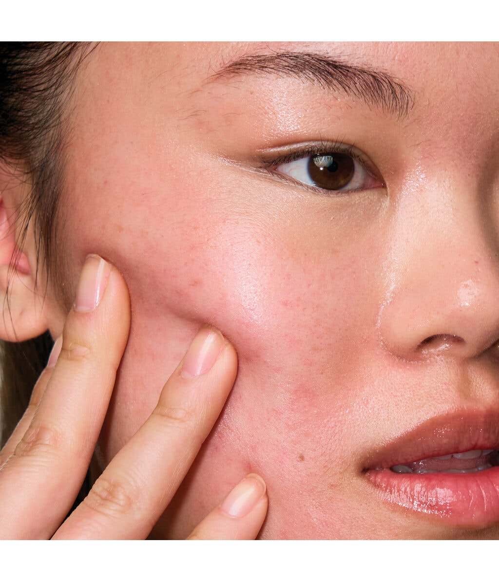 Сыворотка для лица Mantle The Spot Solution 10% Azelaic Acid Treatment Serum, для проблемной кожи, 30 мл — фото 5