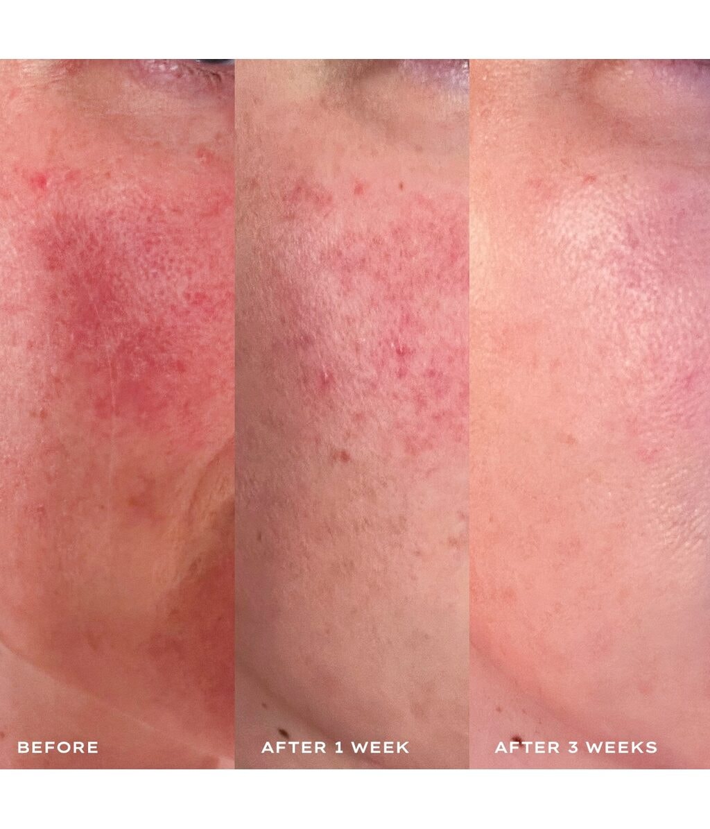 Сыворотка для лица Mantle The Calming Solution 5% Sulfur Treatment Serum, успокаивающая, для чувствительной кожи, 30 мл — фото 3
