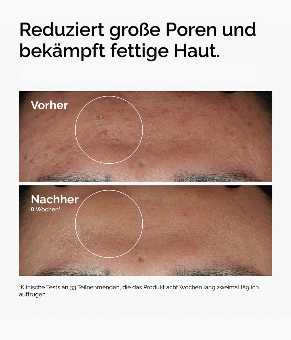 Produktbild 3 von 6, The Ordinary More Molecules Gesichtsserum