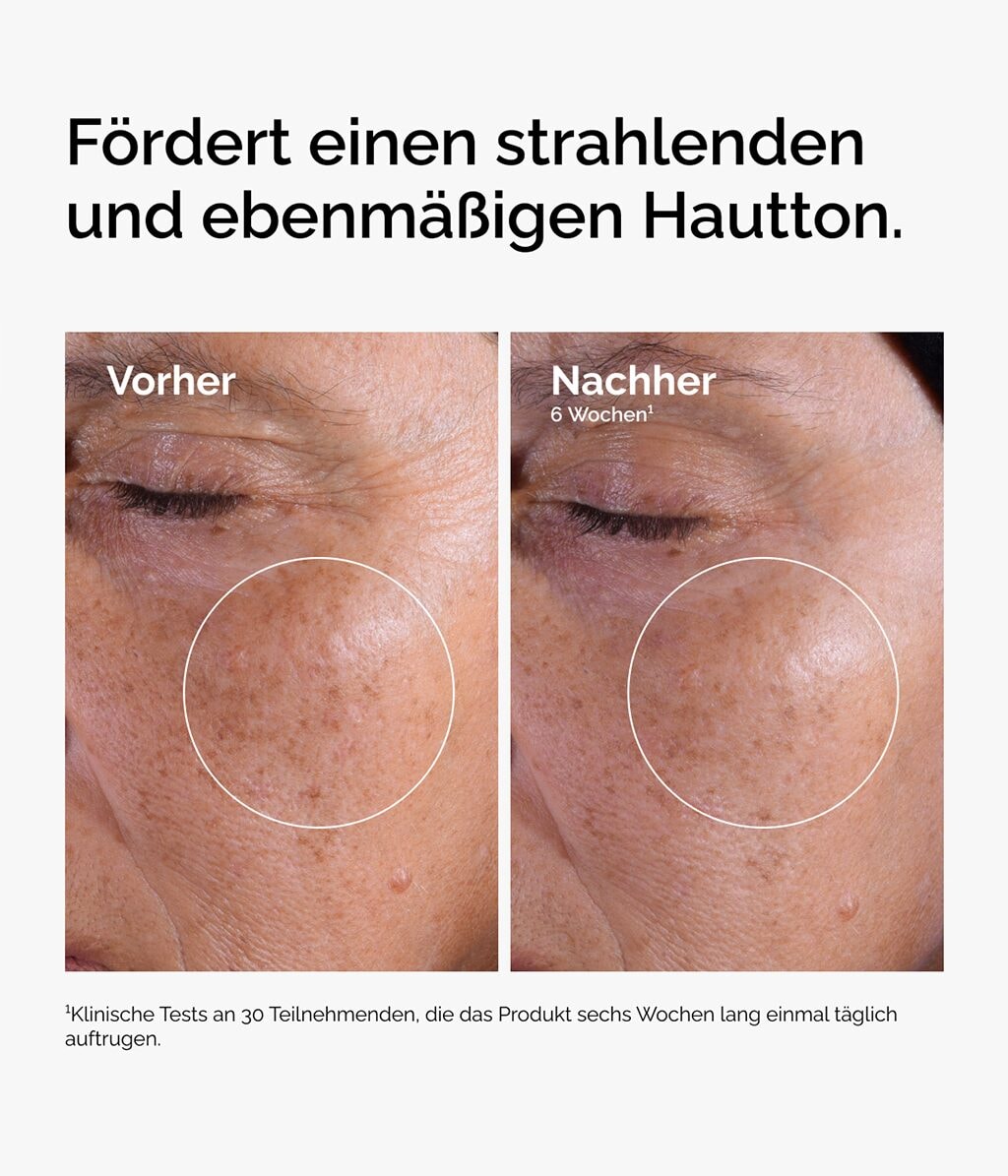 Produktbild 3 von 6, The Ordinary Direct Acids Gesichtswasser