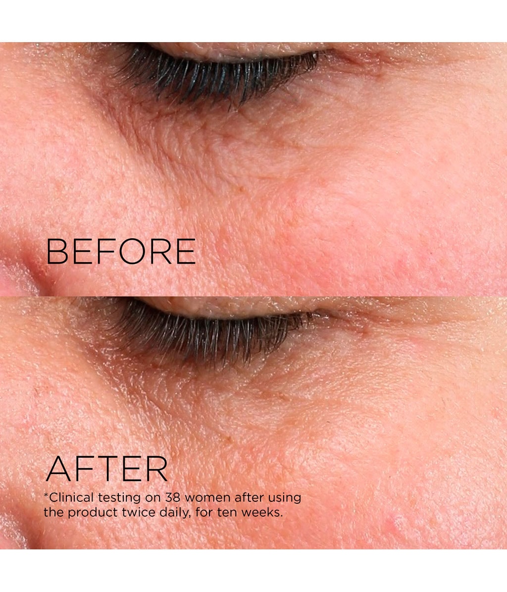 Сыворотка для лица Darphin Eclat Sublime Dual Rejuvenating Micro-Serum, для эластичности, для сухой кожи, 50 мл — фото 4