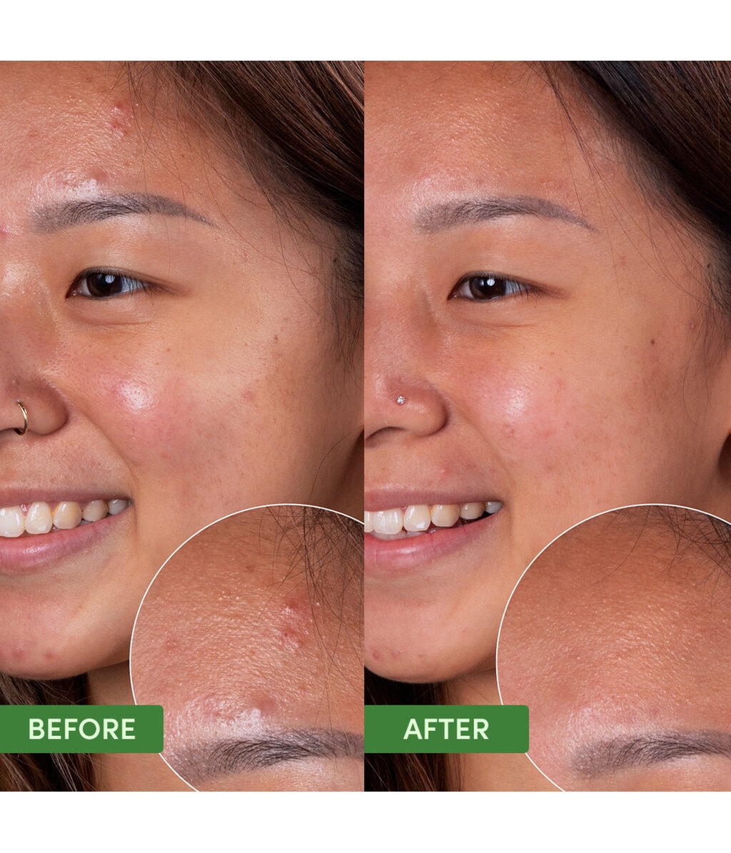 Гель для умывания Sand & Sky Oil Control Clearing Face Cleanser регулирующий себум, для жирной и склонной к акне кожи, 120 мл — фото 3