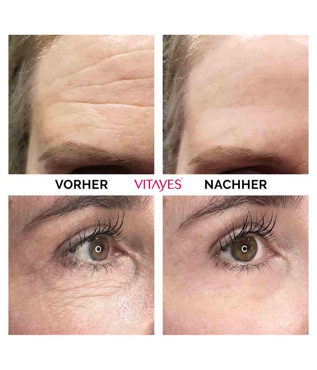 Крем для лица Vitayes Instant Ageback против морщин, с лифтинг-эффектом, 15 мл — фото 4
