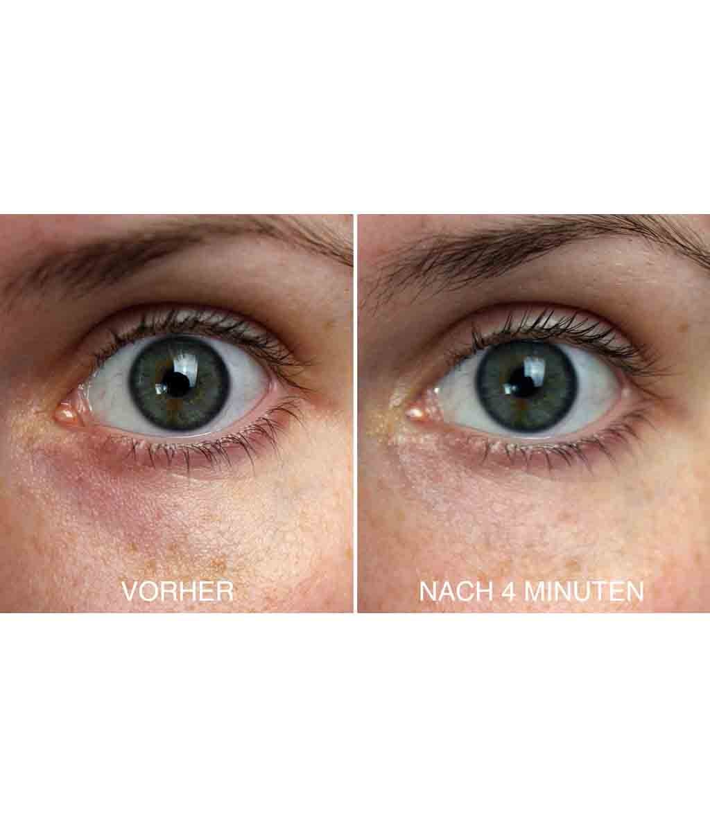 Сыворотка для кожи вокруг глаз Vitayes Perfector Eye Serum, антивозрастная, увлажняющая, 15 мл — фото 3