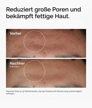 Produktbild 3 von 6, The Ordinary More Molecules Gesichtsserum