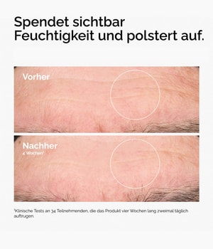 Produktbild 3 von 6, The Ordinary Direct Acids Gesichtsserum