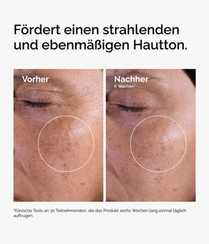 Produktbild 3 von 6, The Ordinary Direct Acids Gesichtswasser